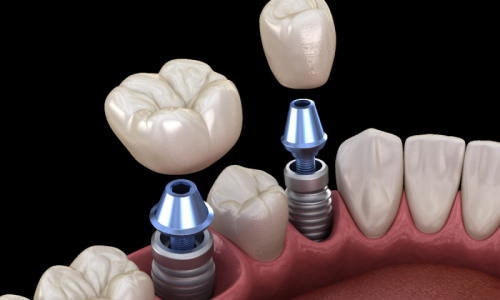 4236ed001ba1a008353bb9fd2de2a79f